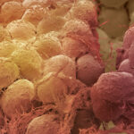 Obesity cellular memory