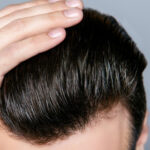 Hair regrowth treatment