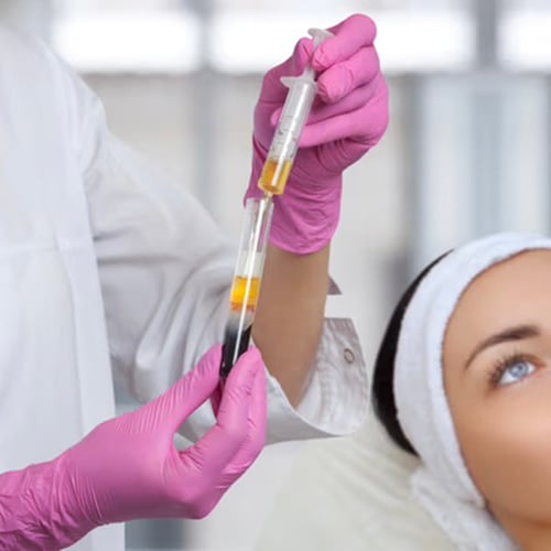 PRP treatment